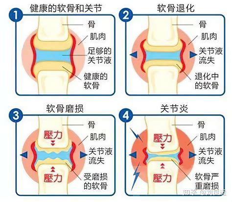 朱德湘|风湿与骨关节病治疗新突破